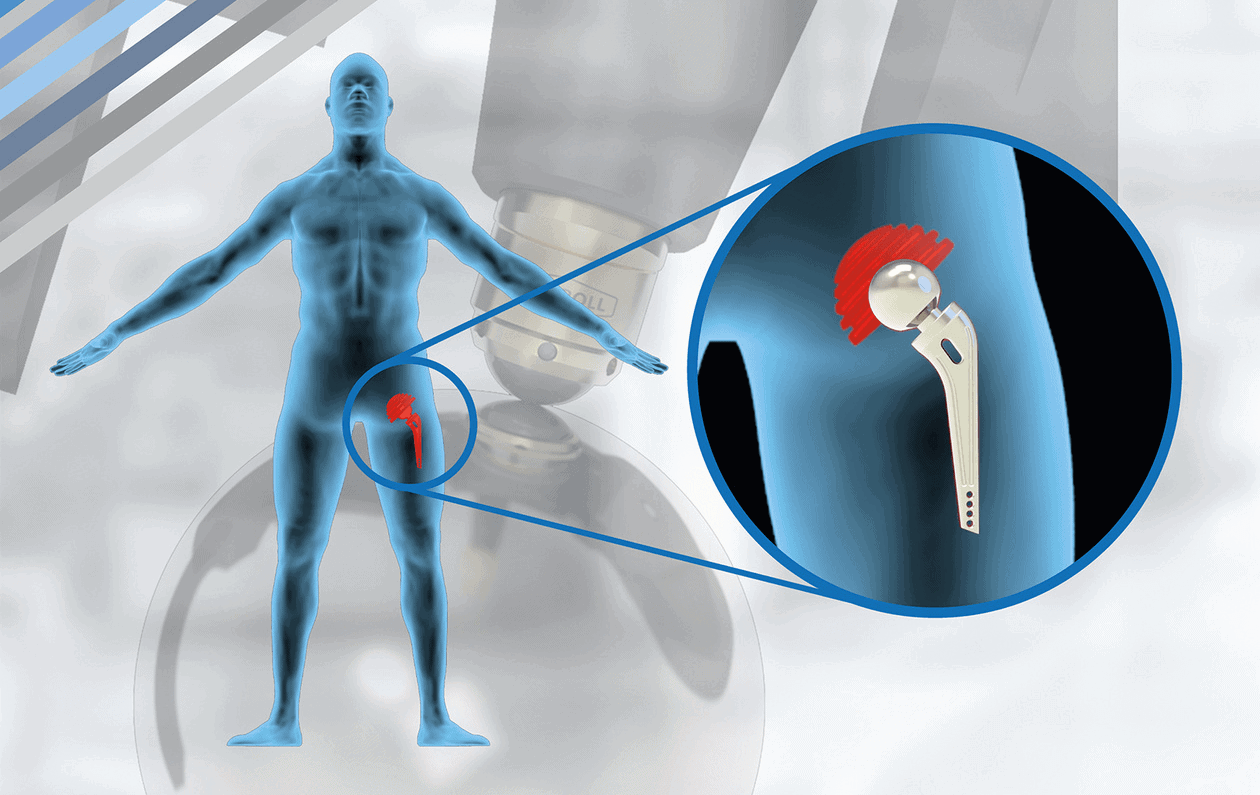 Sostituire la lucidatura tradizionale con la lucidatura con rullo: una storia di successo